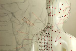 Les outils de la Médecine Chinoise Médecine Traditionnelle Chinoise Acupuncture Pharmacopée Diététique Qi Gong Tai Chi Moxibustion Tuina